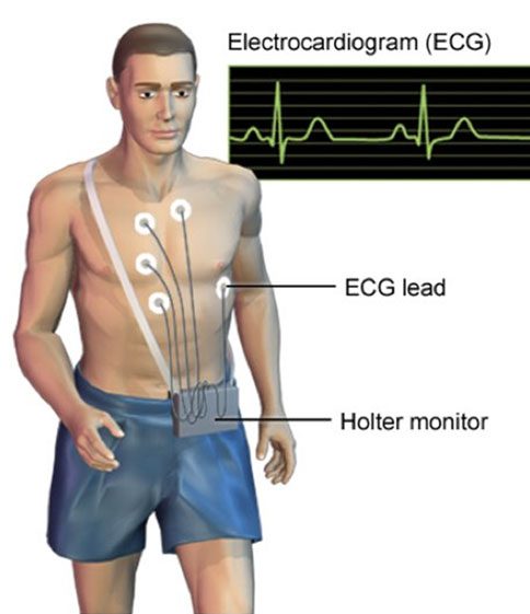 кабель holter ecg